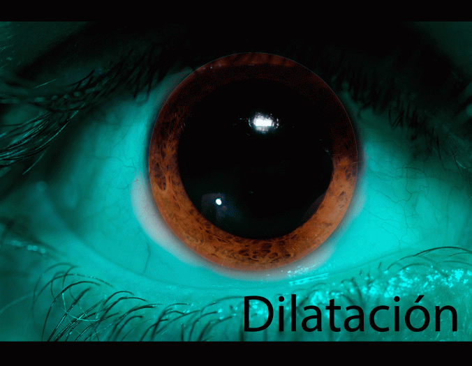 dilatacion1